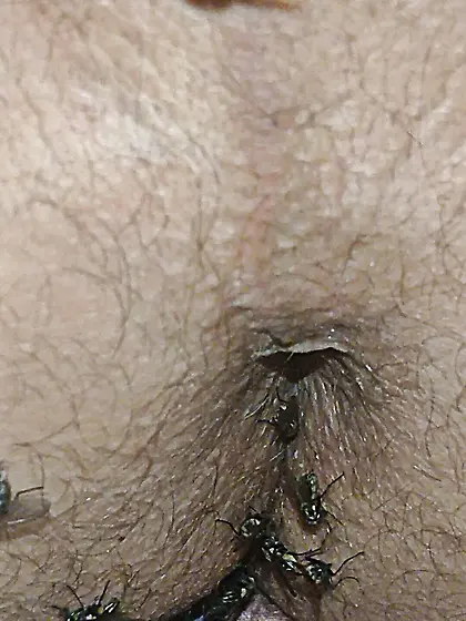 Flies on my anus in the village.  06. 2025