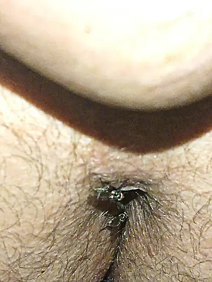 Flies on my anus in the village.  06. 2025