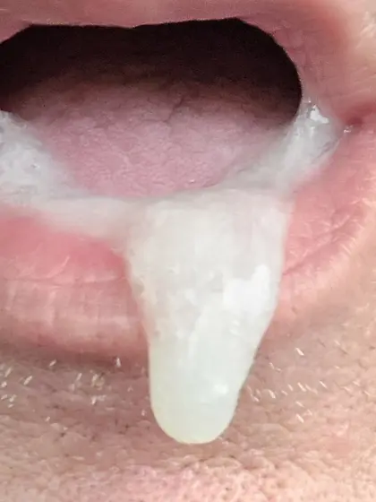 Oral cum dump