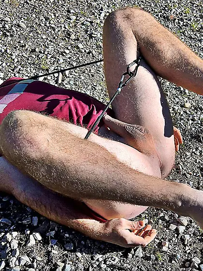 Andy sedated Gymnast 79