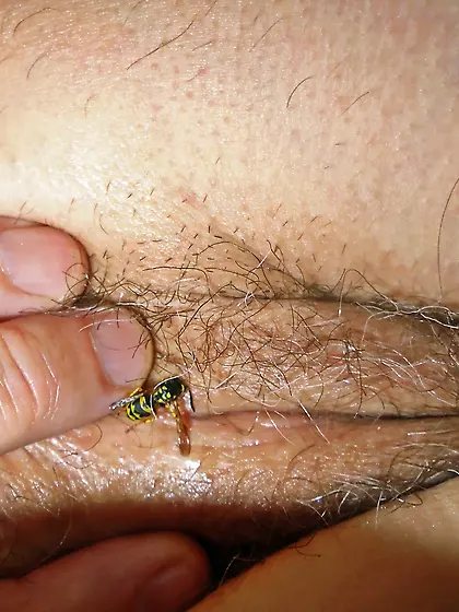 After a hard Day the bugs won't go away 2