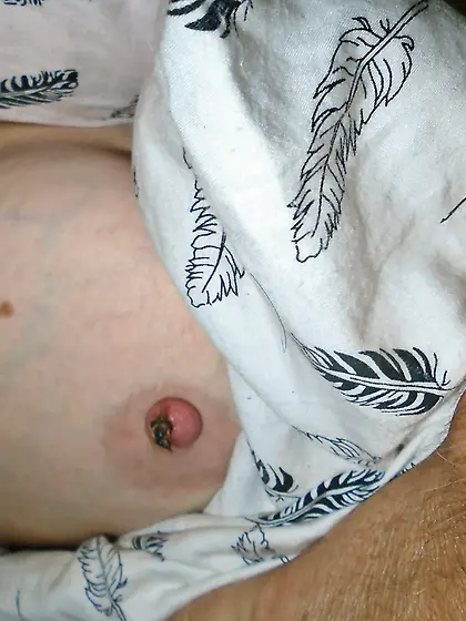 After a hard Day the bugs won't go away 2