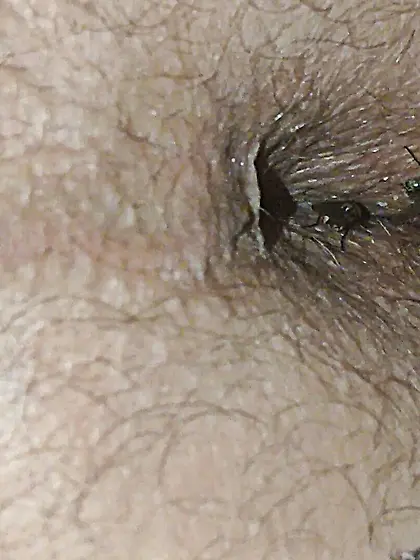 Flies on my anus in the village.  06. 2025