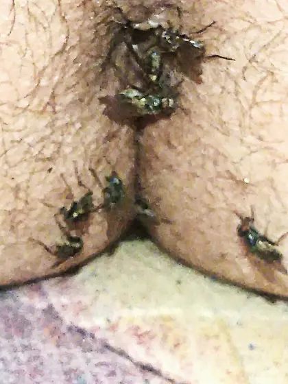 Flies on my anus in the village.  06. 2025