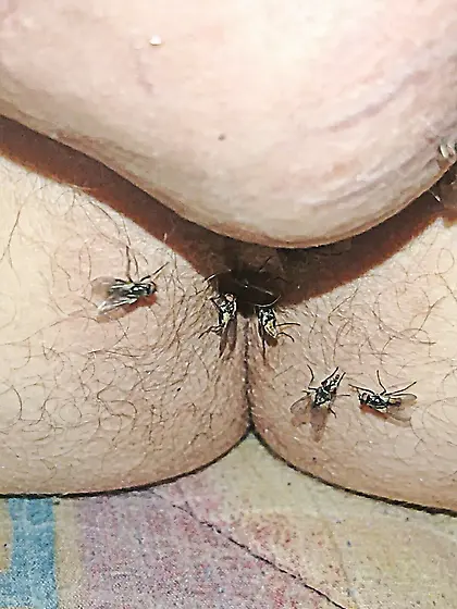 Flies on my anus in the village.  06. 2025