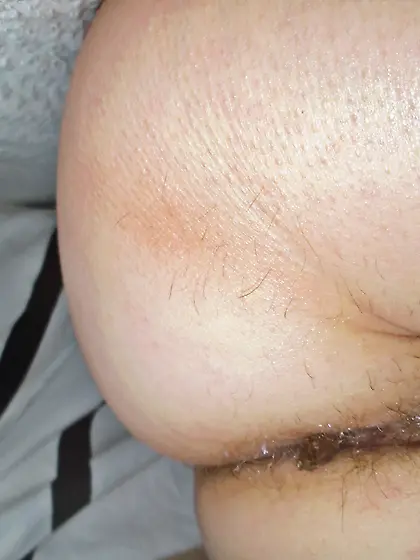 After a hard Day the bugs won't go away 2