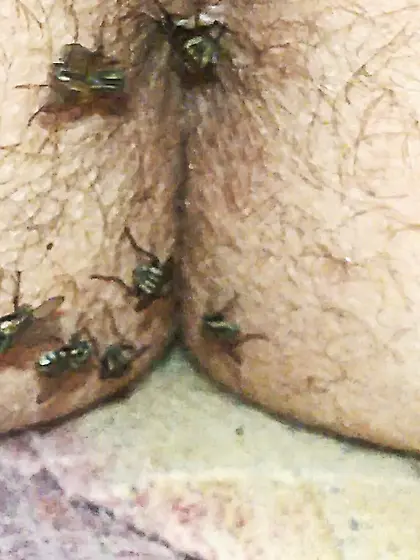 Flies on my anus in the village.  06. 2025