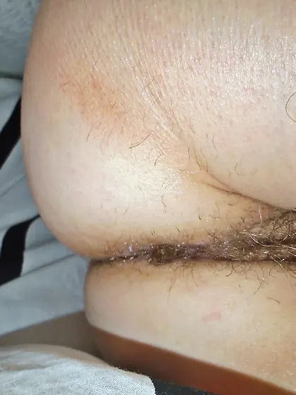 After a hard Day the bugs won't go away 2