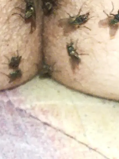 Flies on my anus in the village.  06. 2025