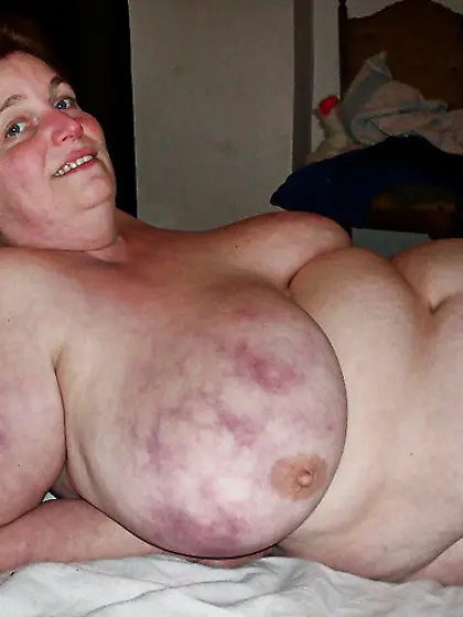 CHANTALE BELLE GROSSE COCHONNE SALOPE