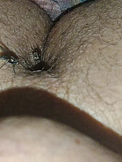 Flies on my anus in the village.  06. 2025