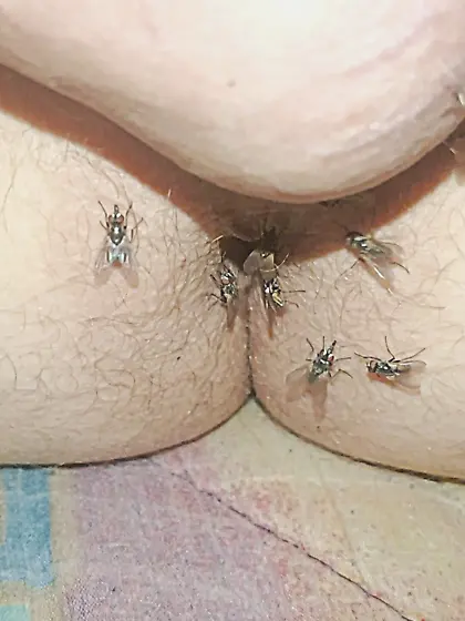 Flies on my anus in the village.  06. 2025