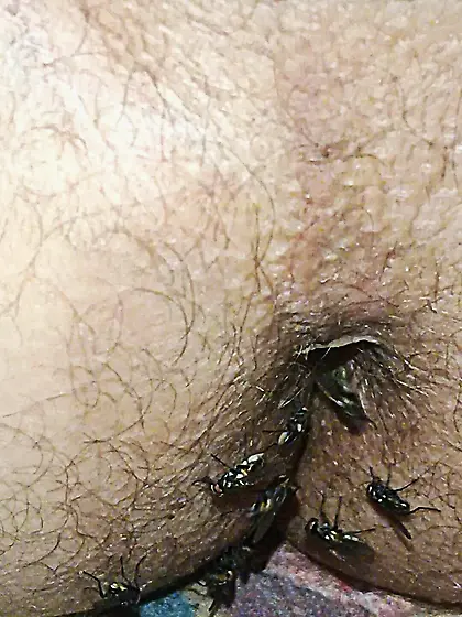 Flies on my anus in the village.  06. 2025