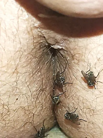 Flies on my anus in the village.  06. 2025