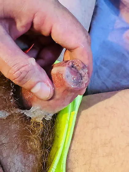 Webslut Shone caught on Chat pic