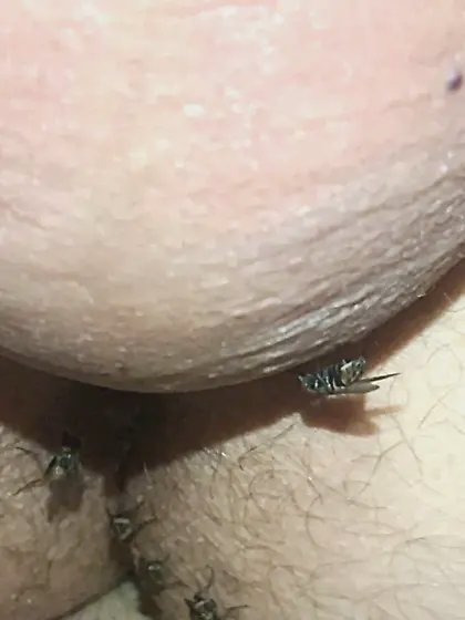 Flies on my anus in the village.  06. 2025