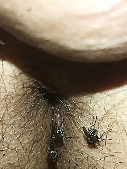 Flies on my anus in the village.  06. 2025