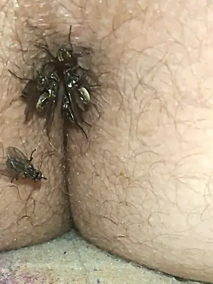 Flies on my anus in the village.  06. 2025