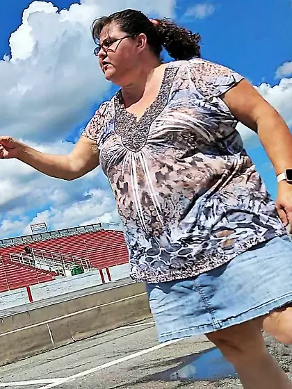 Amputee Kay wants attention